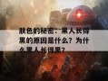 肤色的秘密：黑人长得黑的原因是什么？为什么黑人长得黑？